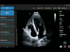 ponta de prova sem fio portátil do ultrassom 3.6MHz posta em fase - transdutor da disposição