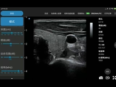 256 linhas de varredura ponta de prova sem fio do ultrassom do transdutor do ultrassom de Ipad para PICC