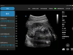 O CE marcou png portátil MPEG-4 do BMP do JPEG dos varredores do ultrassom de 3.6MHz Wifi