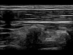Máquina portátil remota 30 Fps do ultrassom de WiFi 12.6cm Doppler