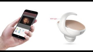 Marvoto Fetus Camera M1- Ultrassom portátil 3D