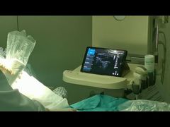 Ultrassom sem fio Golead usado para anestesia