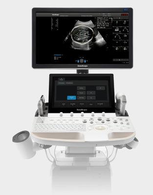 comprar A inteligência artificial baseou o trole P60 Exp da máquina do ultrassom de SonoScape online manufacture