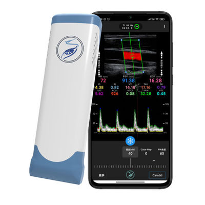 comprar Scanner de ultrassom portátil sem fio de 12 MHz para iPhone e iPad | Sonda Doppler colorida de matriz linear eletrônica online manufacture
