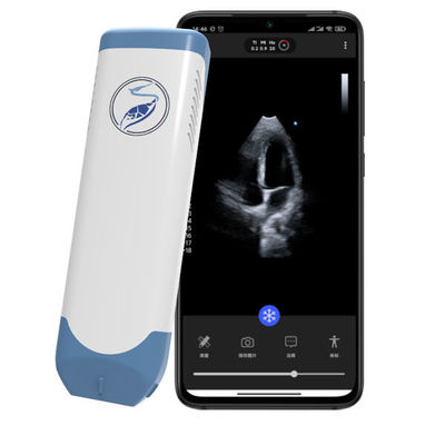 comprar Scanner de ultrassom portátil sem fio Phased Array Ultrassom cardíaco de bolso de 5 MHz para ecocardiografia POCUS online manufacture