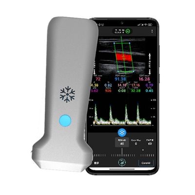 comprar Scanner de ultrassom Doppler colorido portátil linear sem fio WiFi | Imagem em tempo real de 30 FPS | Sonda de ultrassom médica portátil online manufacture