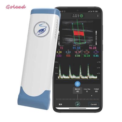 comprar Varredor portátil sem fio eletrônico 12MHz do ultrassom de Wifi da disposição linear online manufacture