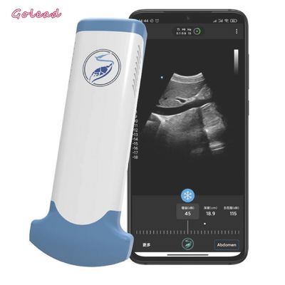 comprar Dispositivo sem fio do ultrassom da disposição convexa eletrônica para o telefone celular online manufacture