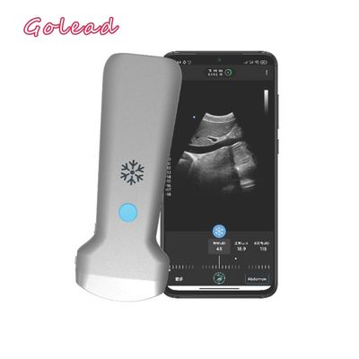 comprar O CE aprovou o ultrassom cardíaco convexo eletrônico da ponta de prova da disposição USG para Android online manufacture