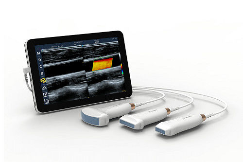 comprar Sonda portátil linear do ultrassom do andróide do varredor 10mhz do ultrassom do tipo-c de usb para vascular e pocus online manufacture
