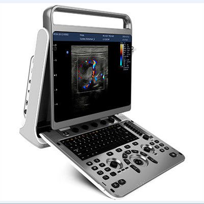 comprar Máquina portátil Chison EBit 30 do ultrassom do projeto ergonômico online manufacture