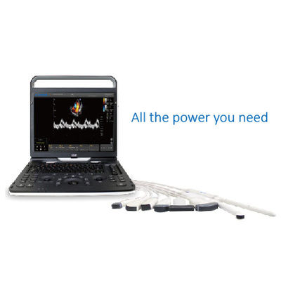 comprar Ultrassom Chison EBit 60 de Wifi de 128 elementos para cardiovascular online manufacture