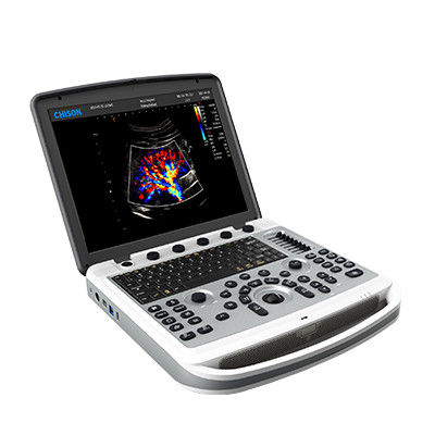comprar Máquina portátil do ultrassom do portátil de 120° Chison SonoBook 6 Rotatable online manufacture