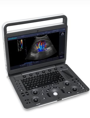comprar 15.6inch ultrassom de BW da máquina do ultrassom do diodo emissor de luz Sonoscape E1 Exp online manufacture