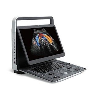 comprar Máquina portátil panorâmico do ultrassom de SonoScape E2 da imagem latente PRO online manufacture