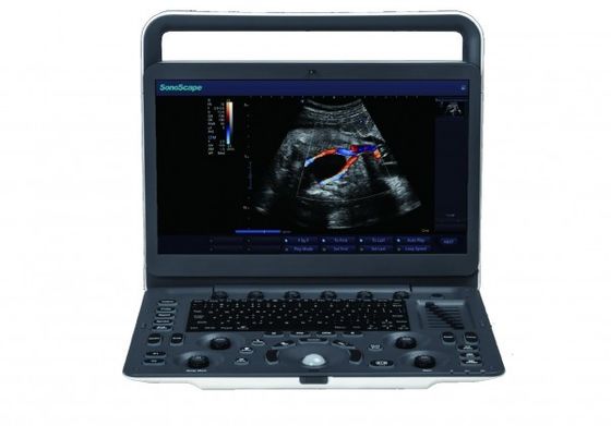 comprar 7 máquina portátil do ultrassom de SonoScape E3 dos níveis da imagem latente com o monitor de 15,6 polegadas online manufacture