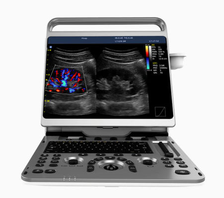 comprar Máquina cardíaca portátil Chison EBit do ultrassom 50 16.5lbs online manufacture