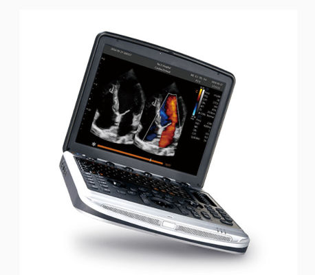 comprar FDA aprovou a máquina Chison SonoBook 8 do ultrassom do portátil para a ecocardiografia online manufacture