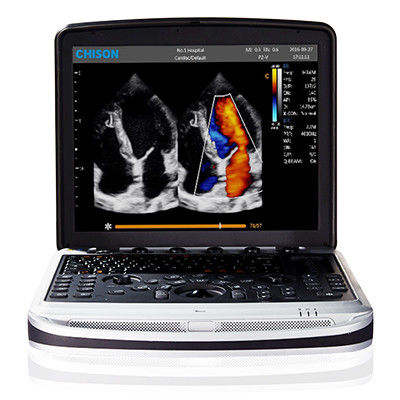 comprar Fácil levar a máquina do ultrassom do portátil de 4D Chison SonoBook 9 online manufacture