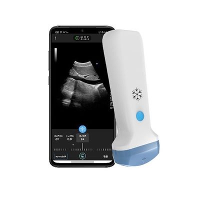 comprar HDMI Output Wireless Convex Handheld Ultrasound Scanner 3.6MHz Portátil Doppler de Cores POCUS Ultrassom online manufacture