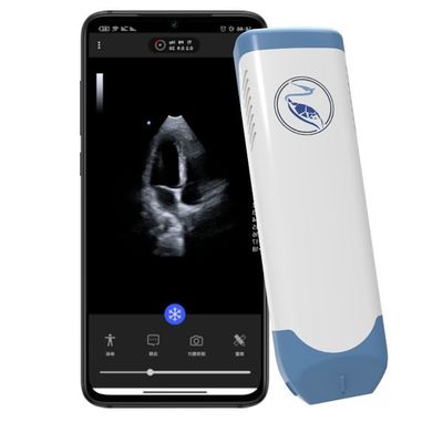 comprar Varredor Handheld do ultrassom da profundidade 18.9cm para Iphone 3.6MHz online manufacture