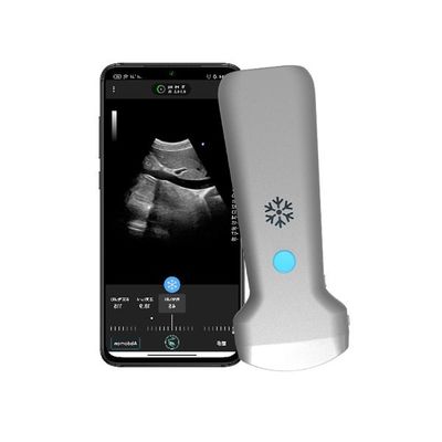 comprar Scanner de ultrassom portátil convexo sem fio ISO13485 | Sonda portátil de ultrassom Doppler colorido online manufacture