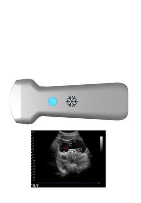 comprar Ponta de prova sem fio convexa do ultrassom de Ultrasonication para a ginecologia online manufacture