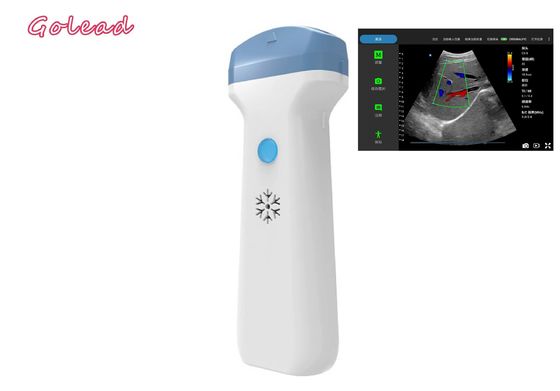 comprar Ponta de prova sem fio do ultrassom de Ipad da anestesia para a atenção primária dos exames de POCUS online manufacture