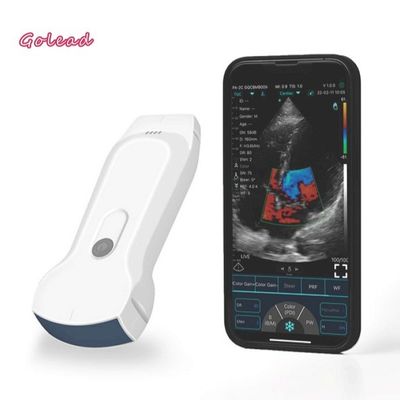 comprar 3 em 1 ponta de prova sem fio do ultrassom com 8 conexão do ajuste TGC WiFi online manufacture
