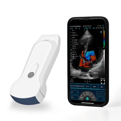 comprar Varredor Handheld portátil do ultrassom de POCUS IPad para o diagnóstico clínico online manufacture