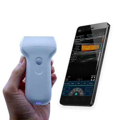 comprar A CE aprovou a ponta de prova portátil sem fio do ultrassom de 96 elementos para o diagnóstico clínico do hospital online manufacture