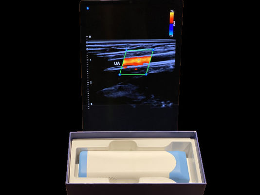 comprar Avançado ultra-som portátil 0.2kg com bateria de 3000mAh para médicos online manufacture