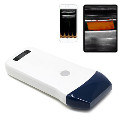 comprar Scanner de ultrassom com sonda linear sem fio para acesso vascular, bloqueio nervoso e imagens musculoesqueléticas online manufacture