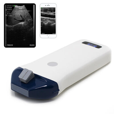 comprar Sistema de ultrassom portátil sem fio para orientação de agulhas e procedimentos intervencionistas online manufacture
