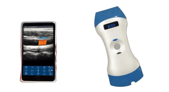 comprar Sonda de ultrassom portátil sem fio de cabeça dupla de 128 elementos — Uma sonda para imagens profundas, imagens superficiais e diagnóstico no local de atendimento online manufacture