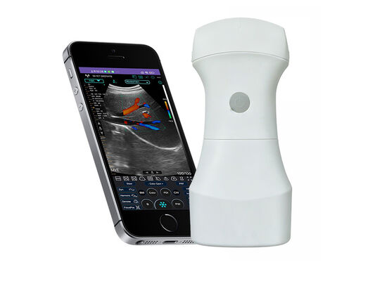 comprar Scanner de ultrassom convexo de bolso sem fio com bateria substituível para imagens clínicas portáteis online manufacture