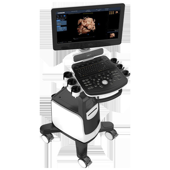 Máquina Chison QBit 7 do ultrassom de Doppler da cor do diodo emissor de luz de 19 polegadas