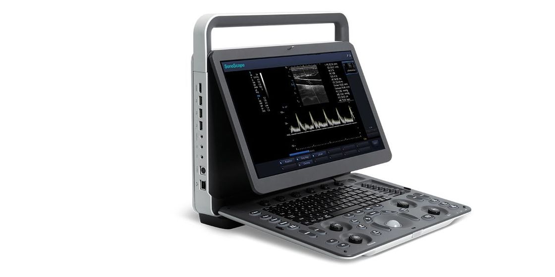 ultrassom portátil de BW da máquina do ultrassom de Doppler da cor do diodo emissor de luz SonoScape de 15,6 polegadas