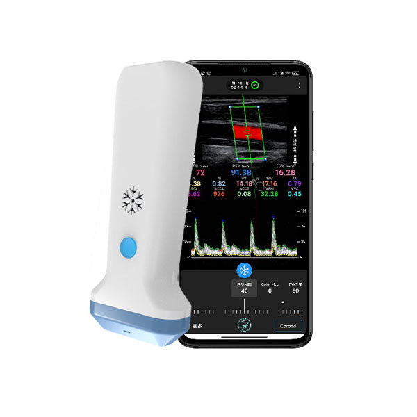Scanner de ultrassom portátil linear sem fio | Sonda portátil de ultrassom Doppler colorido de 4 / 8,3 / 12 MHz