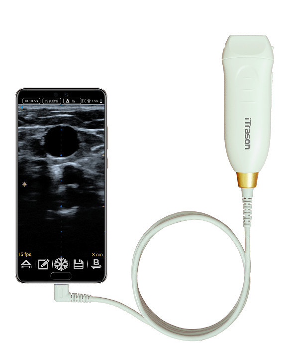 64 Canal 20mm Profundidade Ultra-som portátil Scanner para avaliação vascular periférica e ultra-som-guiado acesso vascular