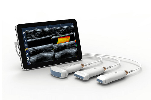 Sonda portátil linear do ultrassom do andróide do varredor 10mhz do ultrassom do tipo-c de usb para vascular e pocus