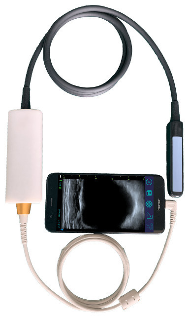Scanner de ultrassom veterinário portátil com sonda retal linear para reprodução bovina e equina