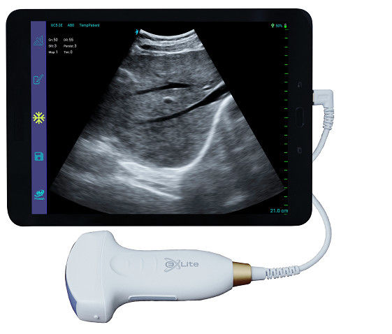 Varredor Handheld 3.5MHz do ultrassom de Doppler da cor convexa eletrônica da disposição