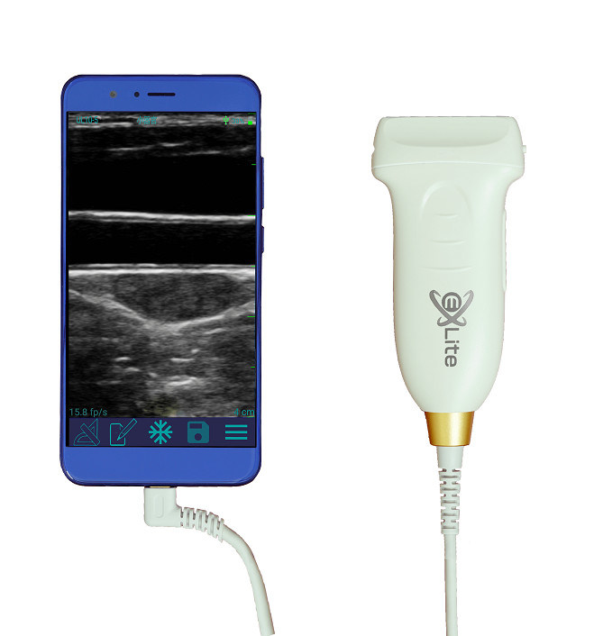 Sonda portátil linear do ultrassom do andróide do varredor 10mhz do ultrassom do tipo-c de usb para vascular e pocus