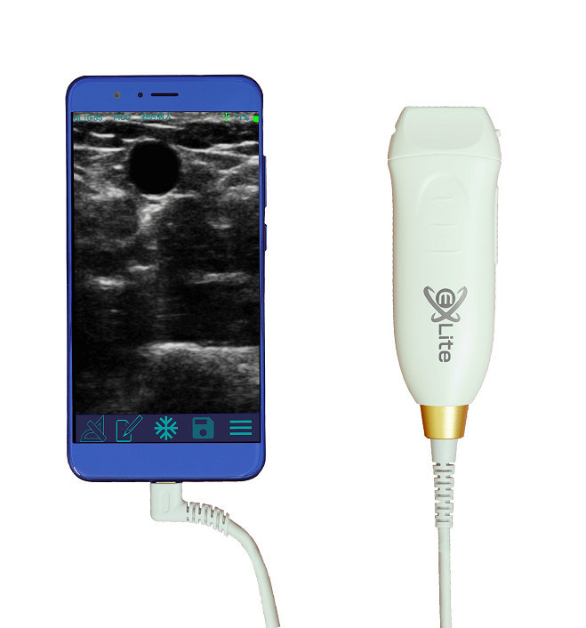 Scanner de ultra-som portátil com sonda linear de alta frequência de 12 MHz para procedimentos precisos de acesso vascular e inserção de PICC