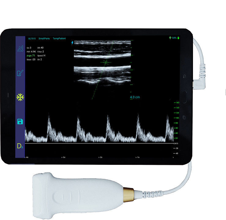 varredor sem fio portátil do ultrassom de 10MHz Android com tipo-c conexão