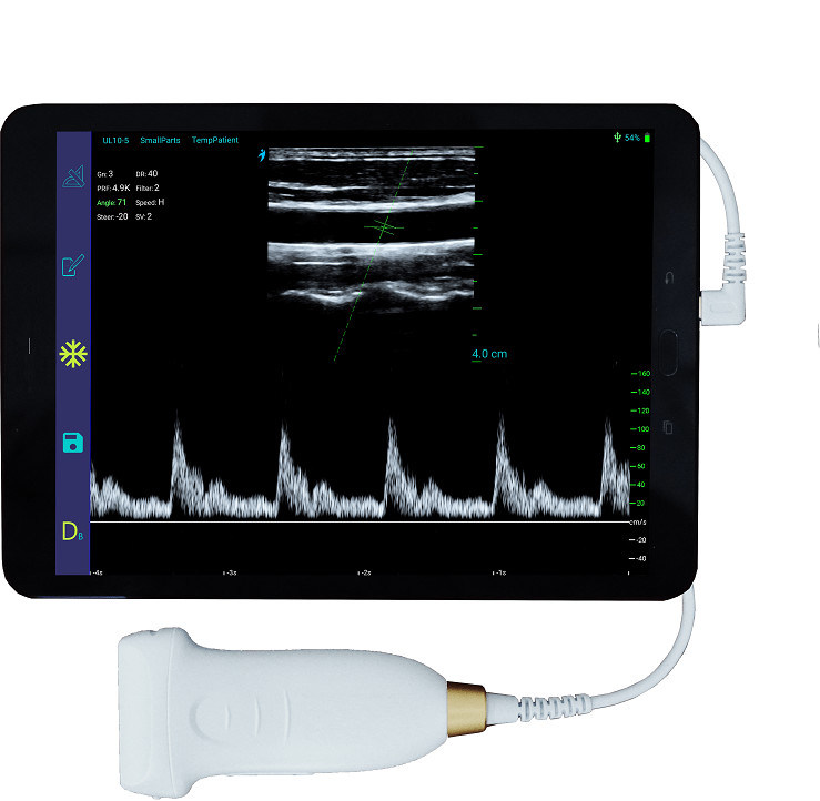 Sonda portátil linear do ultrassom do andróide do varredor 10mhz do ultrassom do tipo-c de usb para vascular e pocus