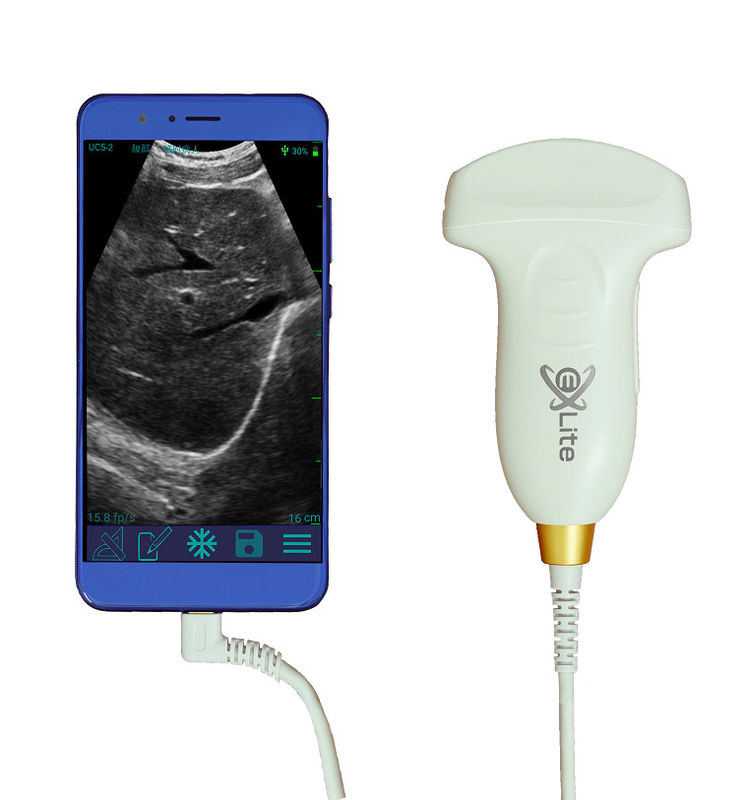 Varredor Handheld 3.5MHz do ultrassom de Doppler da cor convexa eletrônica da disposição