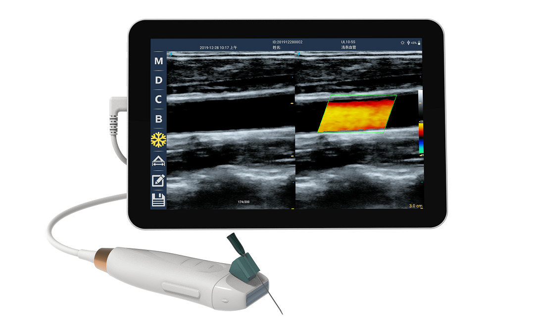 Scanner de ultra-som portátil com sonda linear de alta frequência de 12 MHz para procedimentos precisos de acesso vascular e inserção de PICC