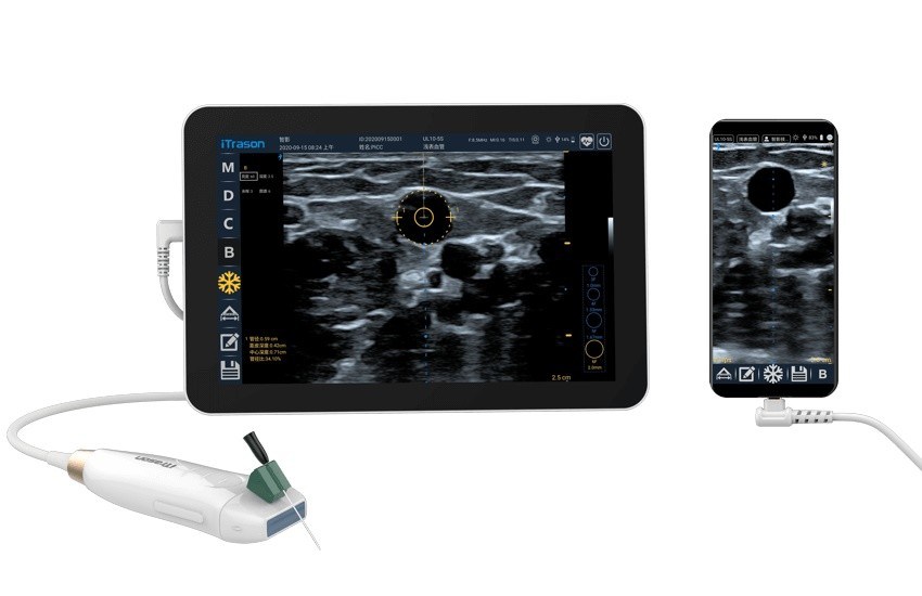 64 Canal 20mm Profundidade Ultra-som portátil Scanner para avaliação vascular periférica e ultra-som-guiado acesso vascular